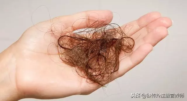 頭髮掉的多吃點啥?頭髮與吃你最關心這4個問題