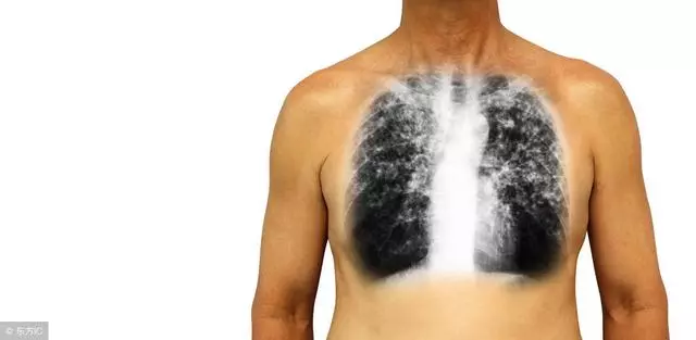 肺不是「突然」癌變的,2件事少做,3樣東西少碰,肺會慢慢變好