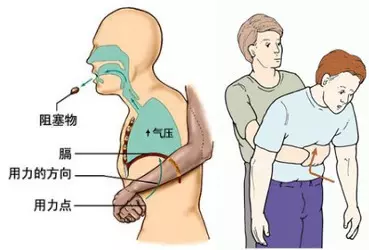 非常實用,魚刺卡到喉嚨怎麼辦?