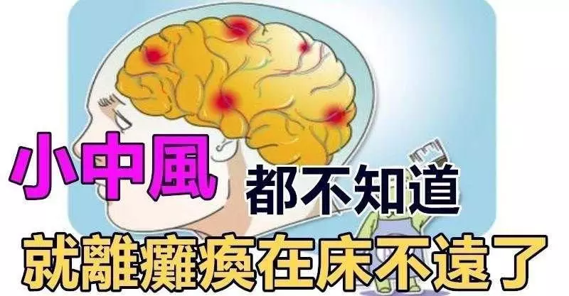 【小中風】先兆微象,每個人都需要知道