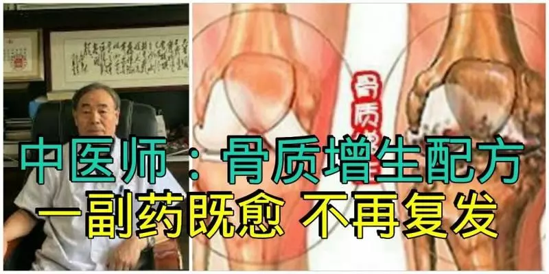 一個民間治癒率極高的「骨質增生」配方,基本上都是一副藥既愈,不再復發!