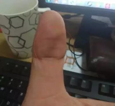 大拇指出現這一信號,就是中風前兆!