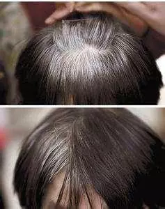 身體自帶的「黑髮劑」,每天堅持按一按,白髮變黑髮,60歲還像40歲!