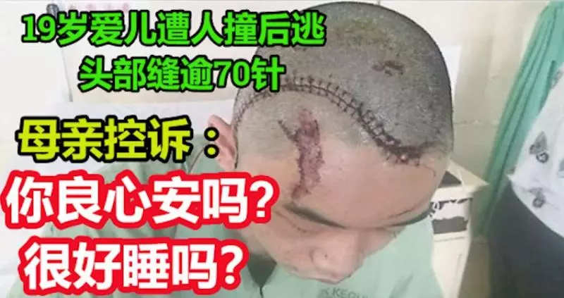 司機逆行肇禍撞後逃,傷者母親控訴, 撞我兒不顧你良心安嗎? 很好睡嗎? 司機逆行肇禍撞後逃,傷者母親