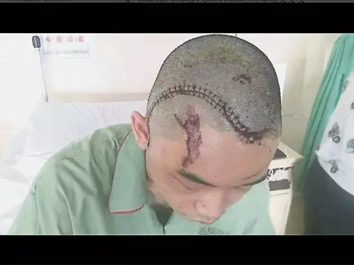司機逆行肇禍撞後逃,傷者母親控訴, 撞我兒不顧你良心安嗎? 很好睡嗎? 司機逆行肇禍撞後逃,傷者母親