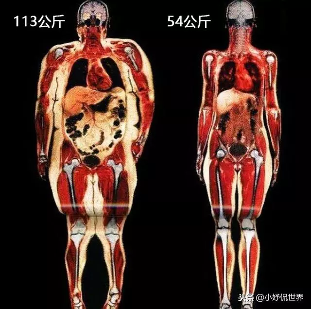 教科書裡看不到的「23張」人體圖片,要比課本里更加有趣得多