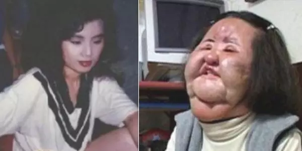 「電風扇大媽」整形失敗,離世享年57歲,人生短短,別強求