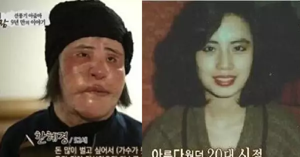 「電風扇大媽」整形失敗,離世享年57歲,人生短短,別強求