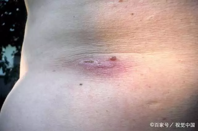 有這10種特徵的最易得癌,看看你和家人有沒有?