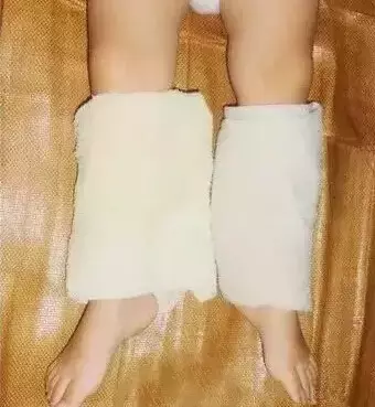 濕毛巾綁在孩子的腿上,奇跡發生了.有孩子的必須看!!