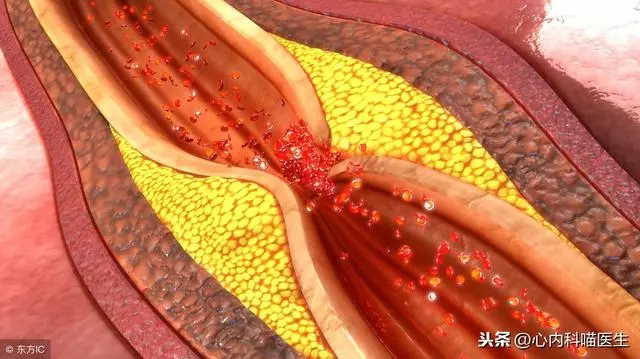 哪些人容易發生「老寒腿」?推薦4個小妙招,讓您的雙腿更健康