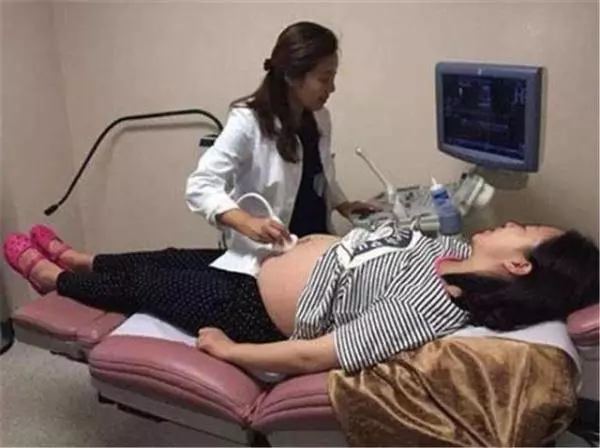 懷孕6個月做孕檢,發現胎兒唇齶裂嚴重,預防唇齶裂這兩點要做好