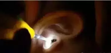 嚇死人!蜈蚣竟躲在女孩築巢,只因床邊放了這個東西!這個習慣其實很多人都有……太可怕了!!