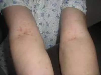 每天拍5分鐘,全身濕氣都排空,早晚各一次,拍一次排一天,排走濕氣一身輕鬆!