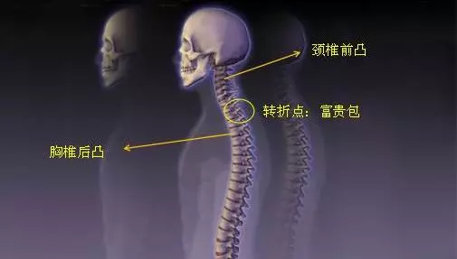脖子上的【富貴包】越長越大?教你3個小動作【自我治療】,富貴包慢慢變小!