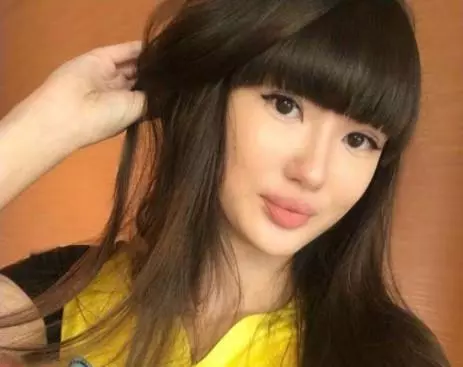 排球美少女「奇蹟天使變網紅臉」 詭異厚唇讓粉絲:還我清純妹子