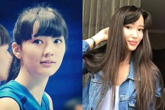 排球美少女「奇蹟天使變網紅臉」 詭異厚唇讓粉絲:還我清純妹子
