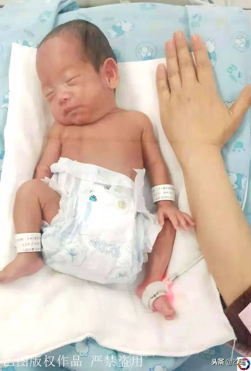孕婦懷孕6個月在家產「掌心寶寶」,急壞家人,住保溫箱2月活下來