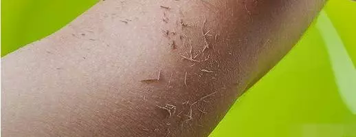 洗澡時搓出來的泥到底是什麼?多數人都搞錯,難怪皮膚還那麼差