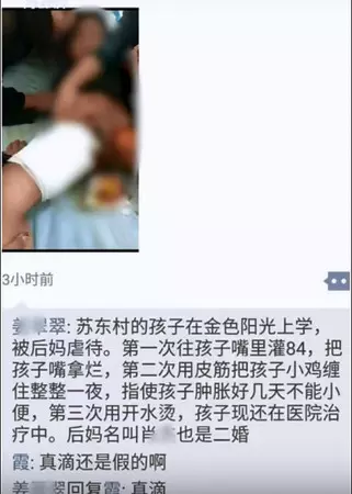 繼母逼喝消毒水還用「滾水私刑」 6歲童下體嚴重燙傷 繼母逼喝消毒水還用「滾水私刑」 6歲童下體嚴重燙