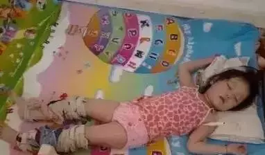 媽媽把濕毛巾綁在孩子的腿上,簡單的自療法,有孩子的必須看!