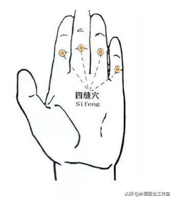 一個穴位對應一個病症,穴位養生法