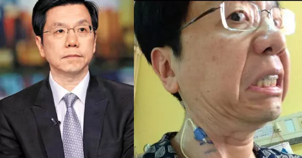 前Google副總裁李開復罹癌,用吃6對策打退淋巴癌