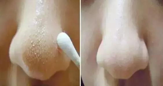 廚房髒抹布加點這個,幾分鐘不用洗也變成新的!趕緊學~