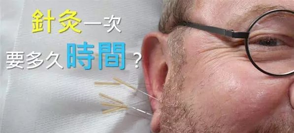 冷知識:針灸一次要多久時間?