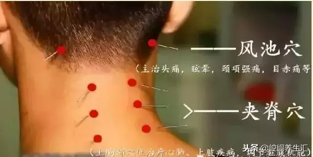 中醫治療頸椎病大全,全是乾貨!