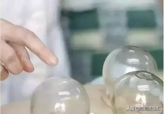 中醫治療頸椎病大全,全是乾貨!