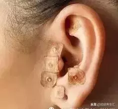 中醫治療頸椎病大全,全是乾貨!