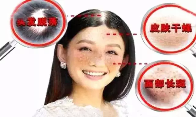 [血瘀體質如何調養]