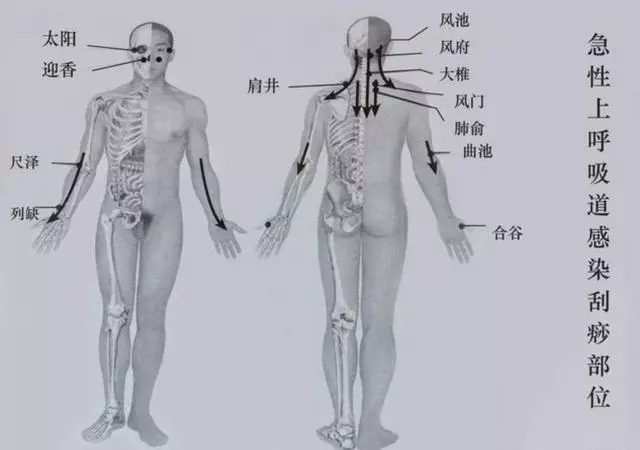 上呼吸道感染、哮喘、支氣管炎刮一刮這幾個部位