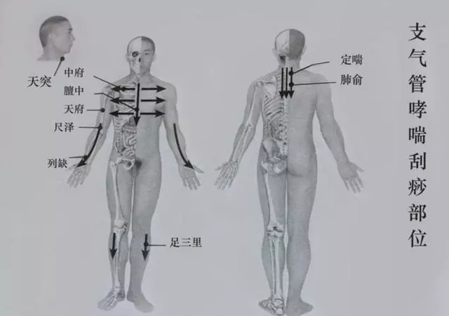 上呼吸道感染、哮喘、支氣管炎刮一刮這幾個部位