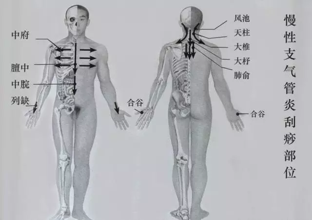上呼吸道感染、哮喘、支氣管炎刮一刮這幾個部位