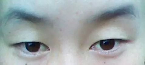 這些部位長的越難看,說明你越有錢花!