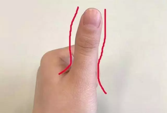 大拇指已經出賣了你,是易胖還是易瘦體質
