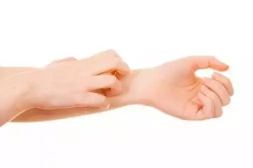 被蚊子咬了又癢又難受!教你簡單一招,不用藥,1分鐘快速止癢!