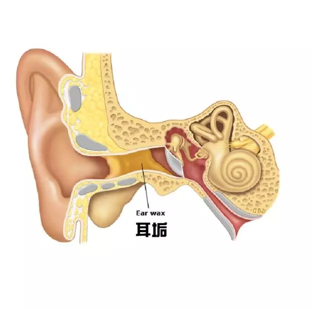 「耳鼻喉科」教授告訴你:「耳垢」不是垢!三要訣:別掏、別挖、別清理!