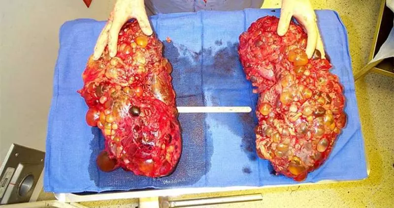 老中醫的「腎臟排毒法」,多吃「這個」對腎臟去瘀消腫超有效!