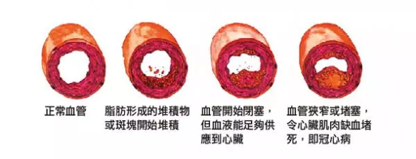 通血管之良藥 ! 超過萬人轉發!【轉發救人】