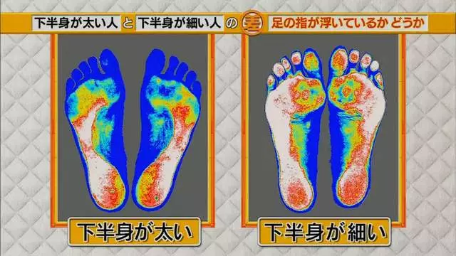 腿粗和腿細的人「關鍵就在腳趾站姿」很少人發現 「一條繃帶」馬上讓象腿瘦下來!