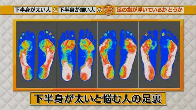 腿粗和腿細的人「關鍵就在腳趾站姿」很少人發現 「一條繃帶」馬上讓象腿瘦下來!