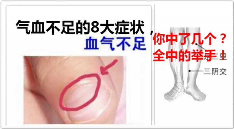 氣血不足的8大症狀,你中了幾個?