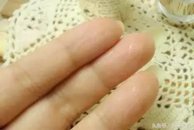 氣血不足的8大症狀,你中了幾個?