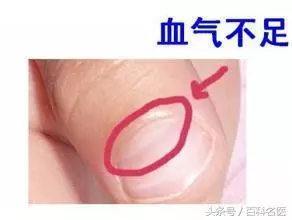 氣血不足的8大症狀,你中了幾個?