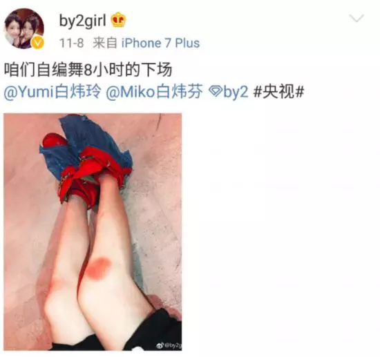 BY2陪你走過的青春,BY2這些年都做了些什麼?