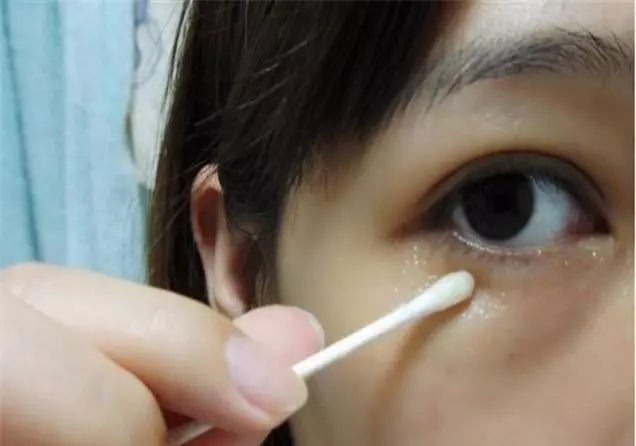 女人有眼袋愛打玻尿酸?別傻了!塗點廚房便宜貨,兩周撫平眼袋