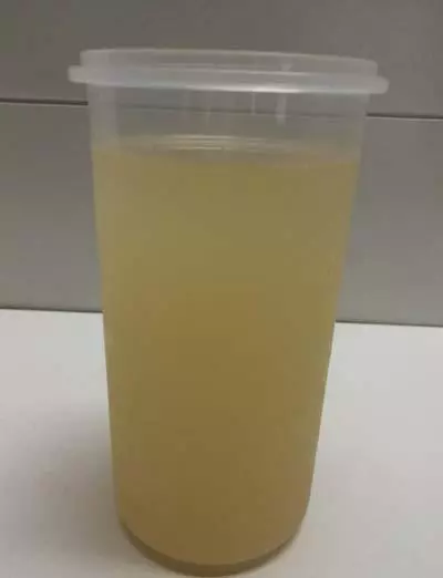 林依晨每天喝一杯:成功瘦14公斤,膚白彷彿回到20歲,減肥效果超棒,做法簡單,快收藏吧!